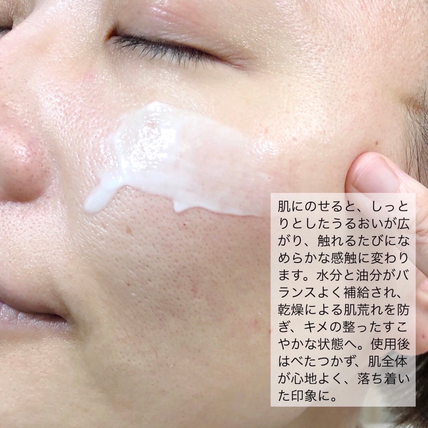 ノスカナイン トラブル セラム/FATION/美容液を使ったクチコミ(5枚目)