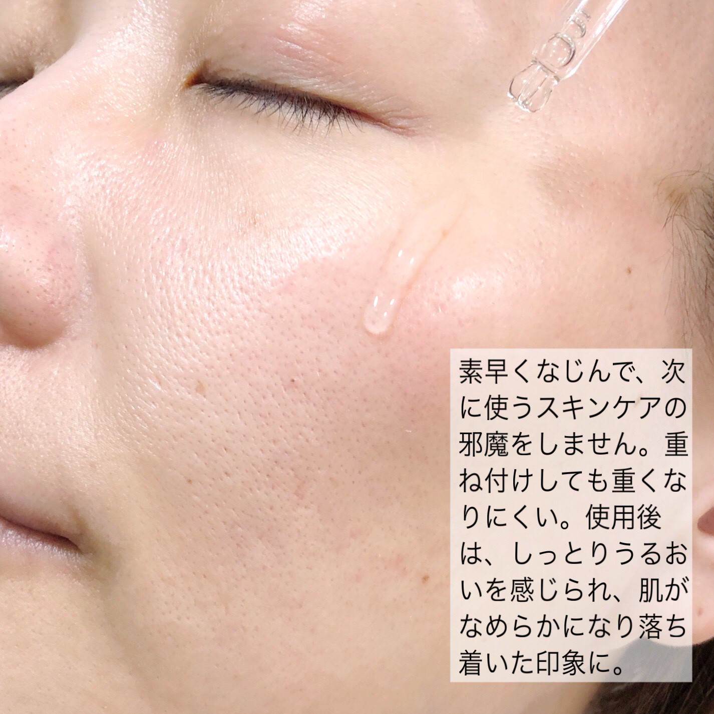 ノスカナイン トラブル セラム/FATION/美容液を使ったクチコミ（3枚目）