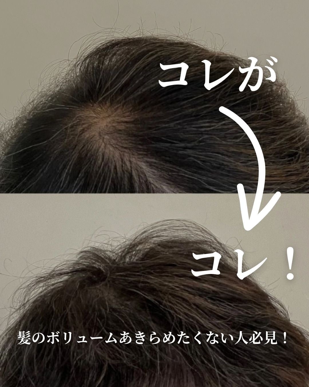 ボリューマイジング&スーディングヘアトニック/SallyZen/頭皮ローションを使ったクチコミ(1枚目)