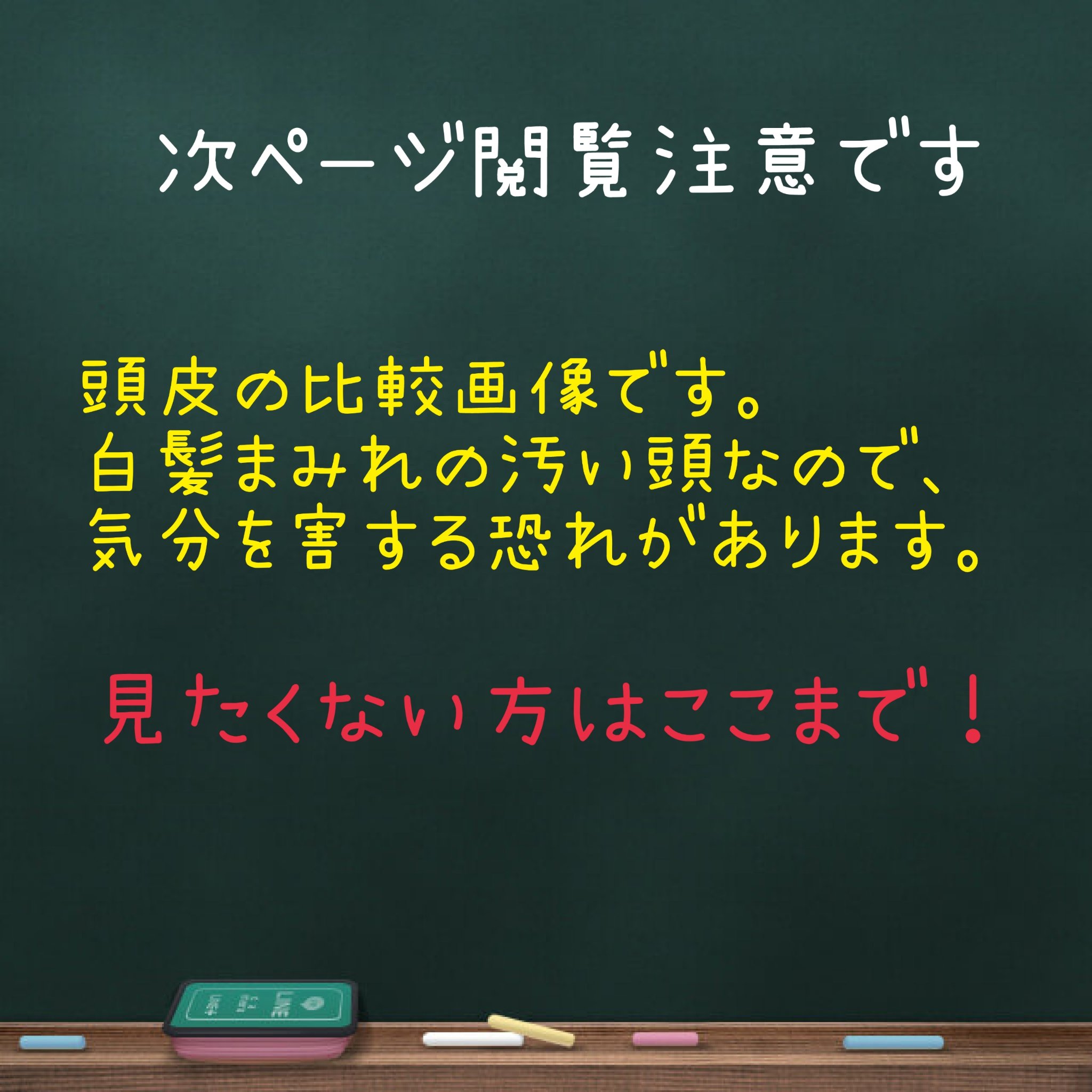 モルティ 薬用育毛エッセンス/モウガL/頭皮ローションを使ったクチコミ（2枚目）