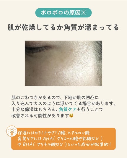 ãµãð·å¢æãåå¿è
ã¡ã€ã¯ on LIPS ãäžå°ããã¡ã³ããå¡ã£ãåŸã®è¬ã®æ¶ãã«ã¹ã¿ãããªãã€âŠã¢ã¬ã¯èã«..ãïŒ4æç®ïŒ