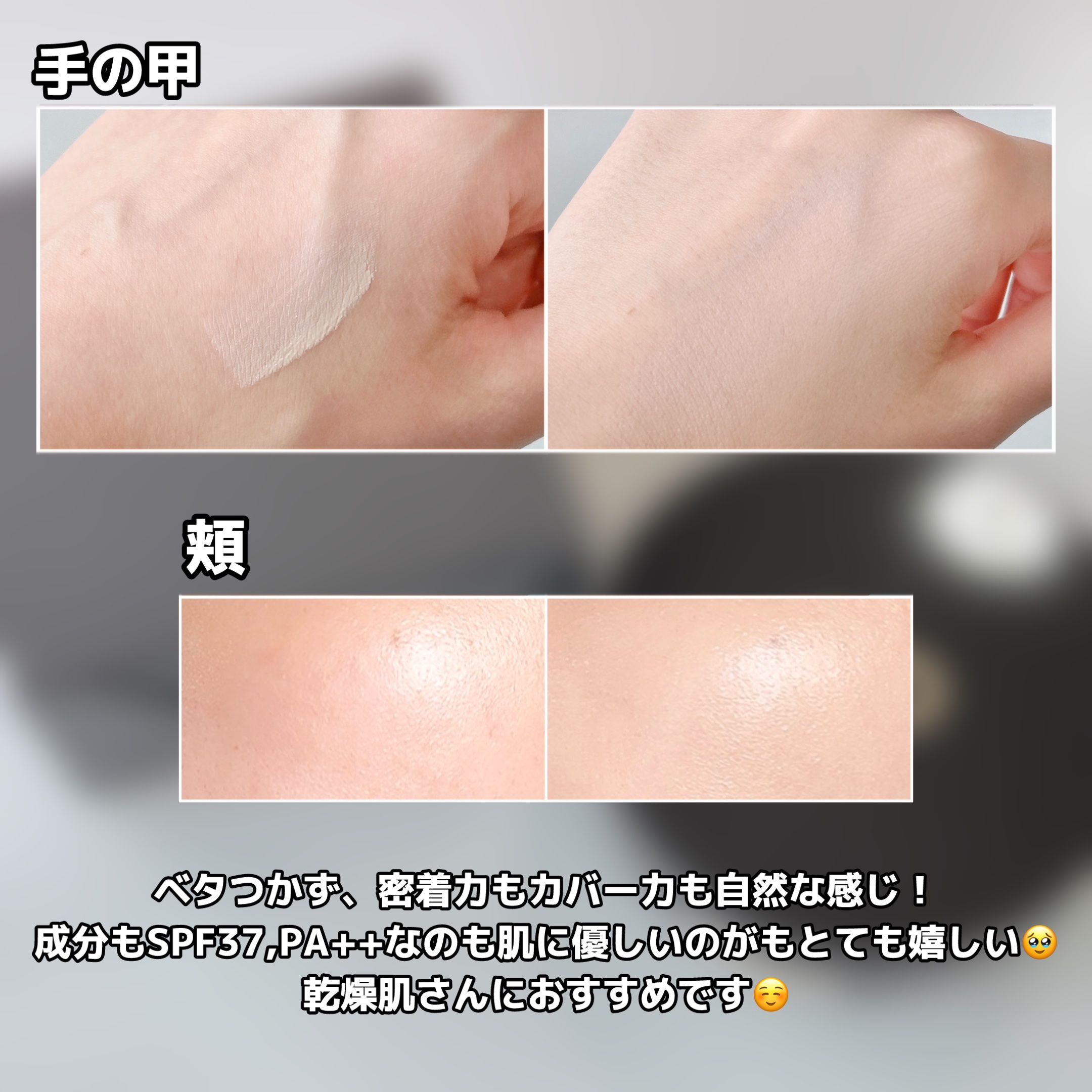 ディロングBBクリーム/RENODERM/BBクリームを使ったクチコミ（3枚目）