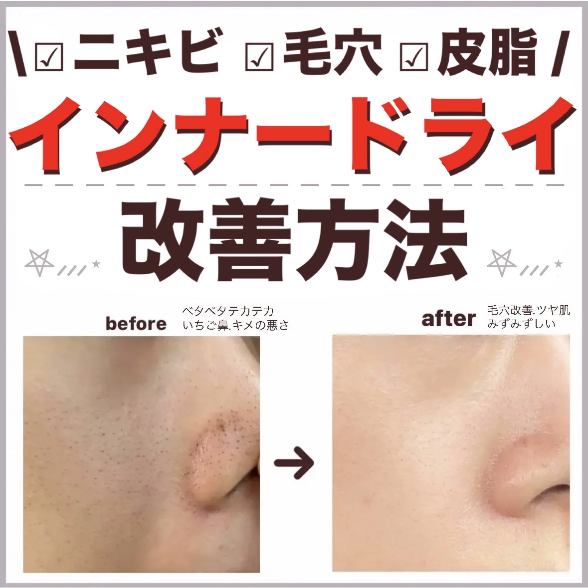 スキンモイストW/PLUSRESTORE/乳液を使ったクチコミ（1枚目）