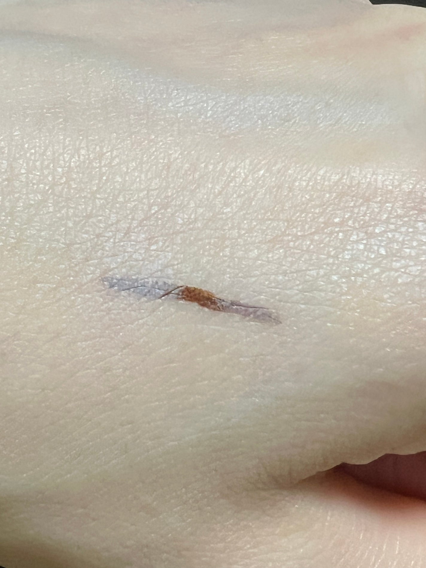 クマメンテパウダー/muice/パウダーコンシーラーを使ったクチコミ(2枚目)