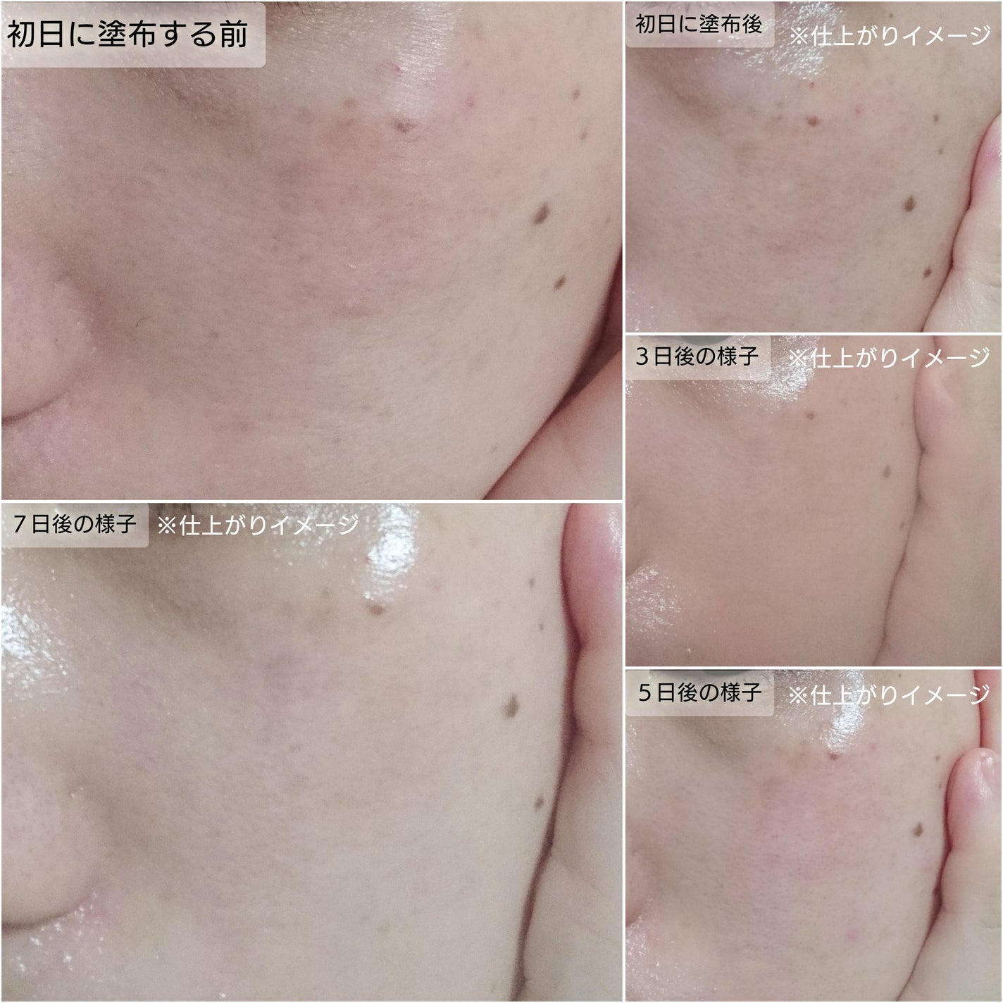 PDRN+リードルS 100/VT/美容液を使ったクチコミ(2枚目)