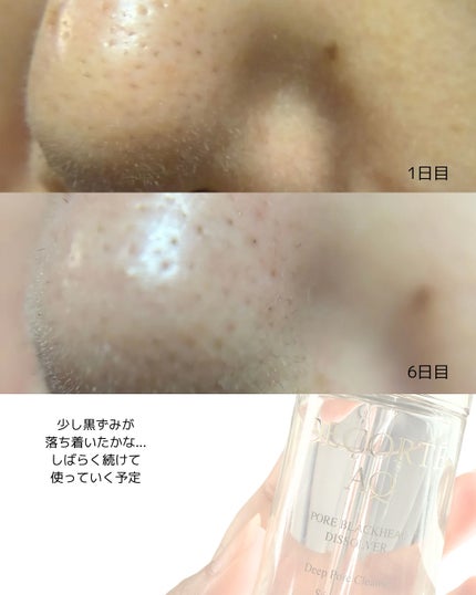 AQ 毛穴美容液オイル/DECORTÉ/フェイスオイルを使ったクチコミ(4枚目)