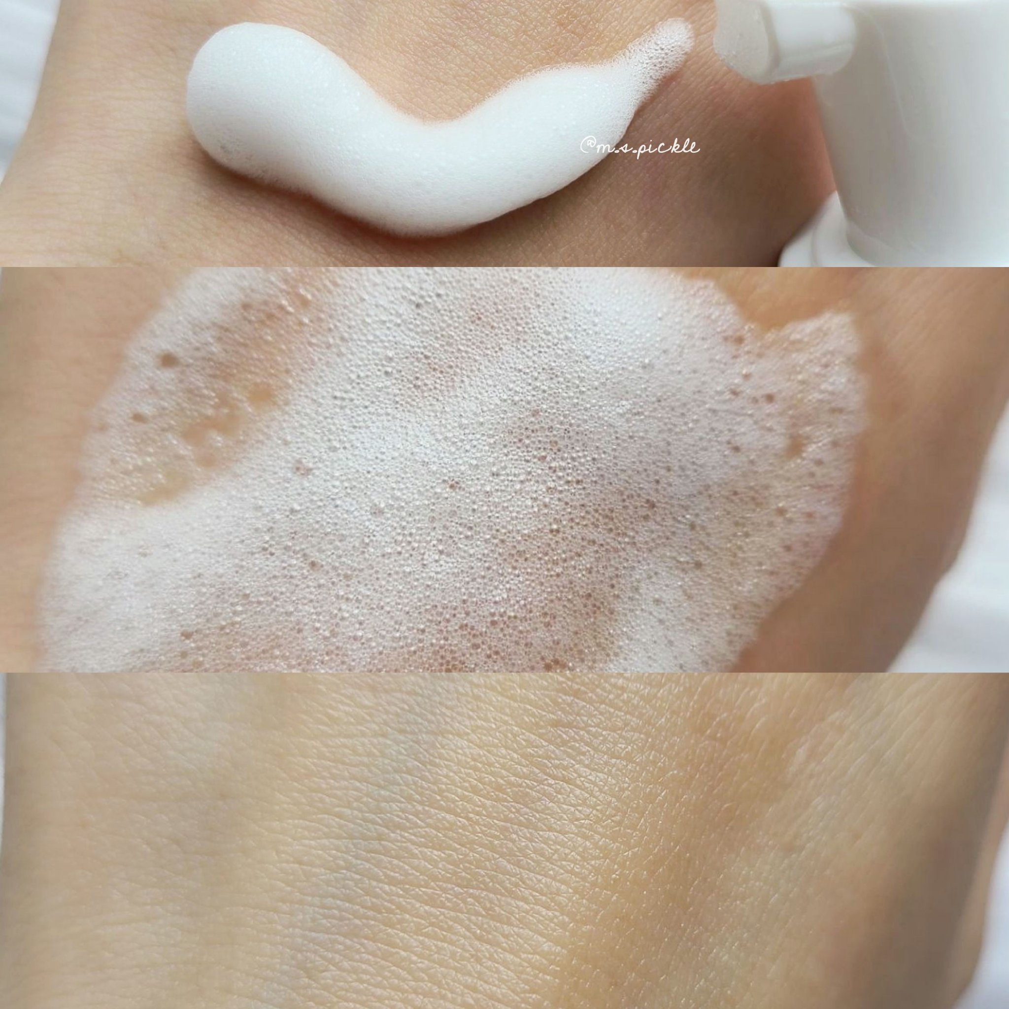 AZ AHA レッドマイクロバブルセラム/VT/美容液を使ったクチコミ（2枚目）