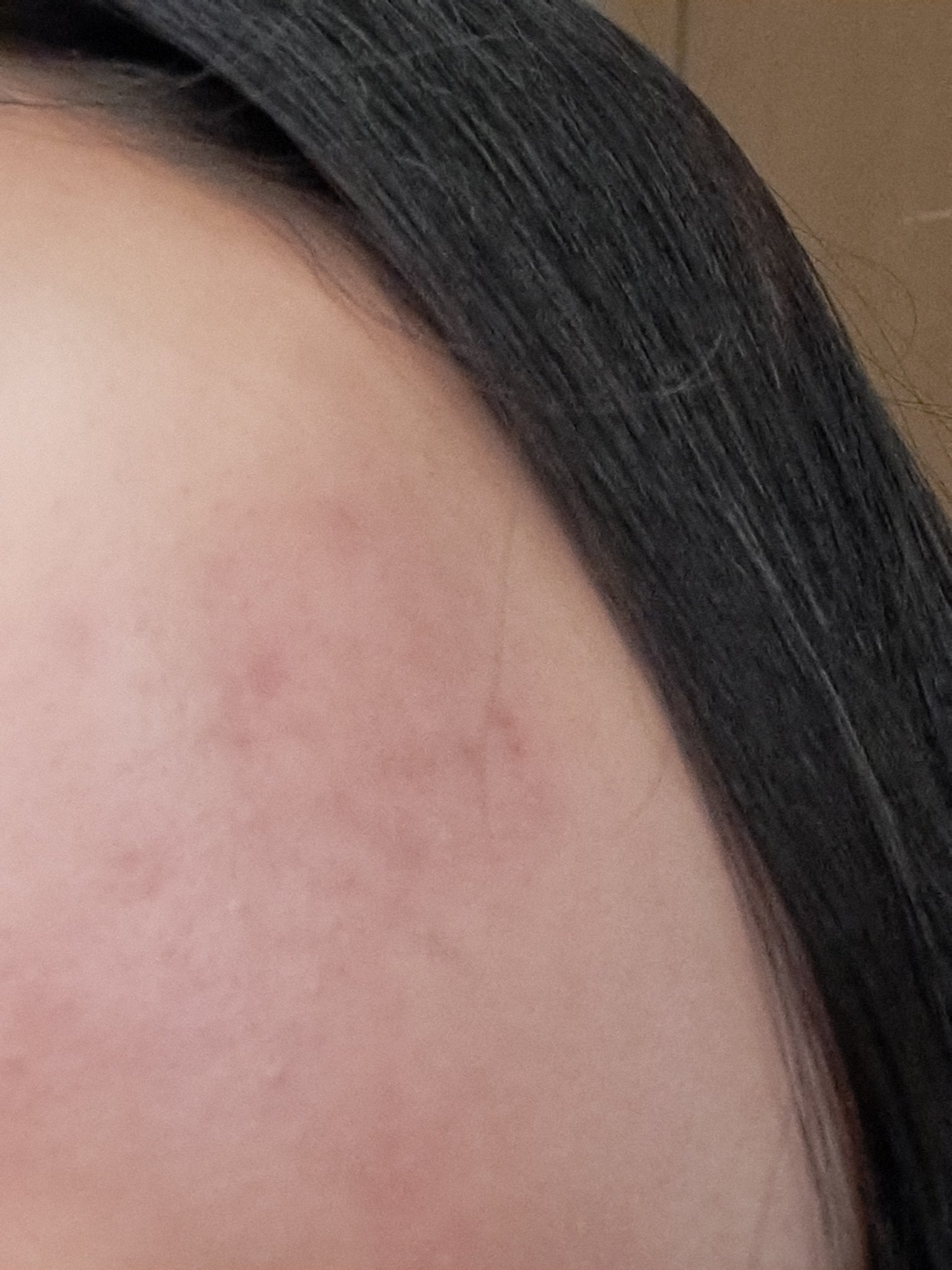 薬用ローション（とてもしっとり）/IHADA/化粧水を使ったクチコミ（2枚目）