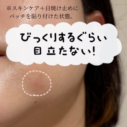 プロCICA クリアスポットパッチ/VT/その他スキンケアを使ったクチコミ(3枚目)