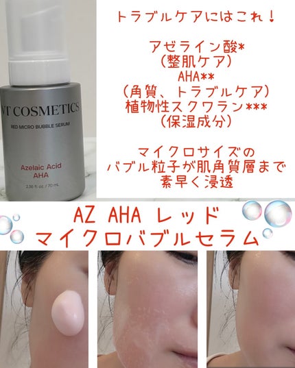 PDRN ヒアルロン酸 ミントマイクロバブルセラム/VT/美容液を使ったクチコミ(3枚目)