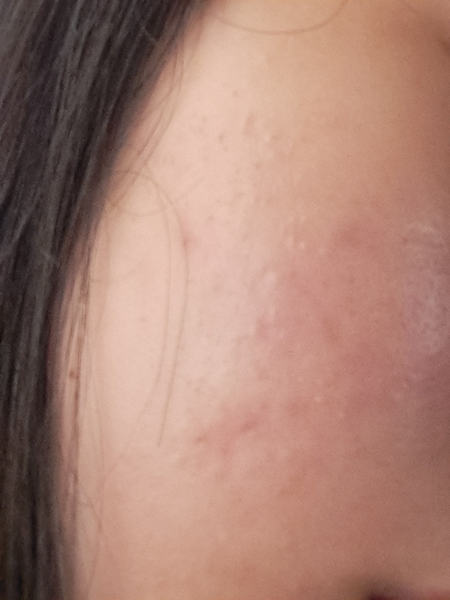 薬用ローション（とてもしっとり）/IHADA/化粧水を使ったクチコミ（1枚目）