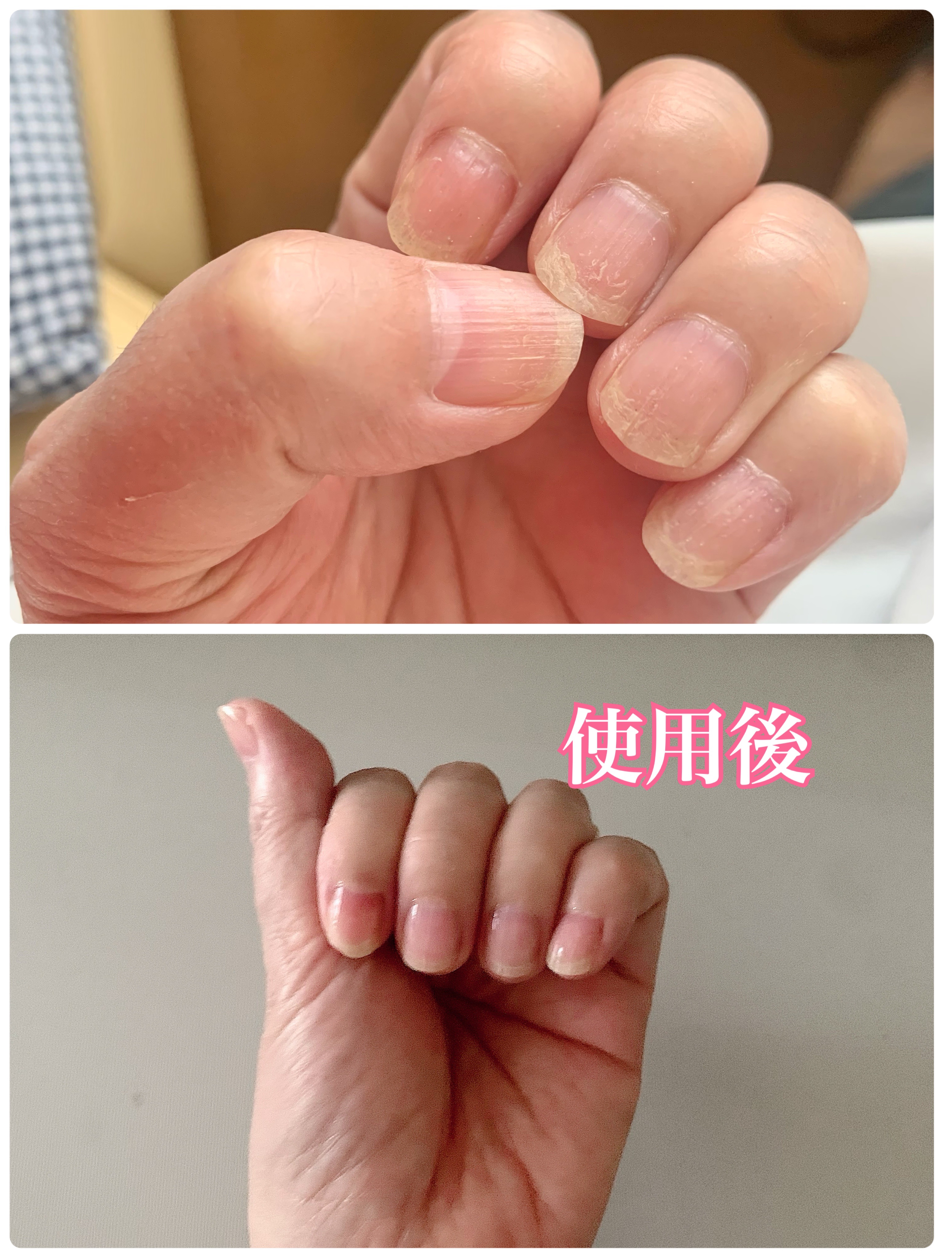 シルクリペアネイルクリーム/COSNORI/ネイルオイル・トリートメントを使ったクチコミ（3枚目）