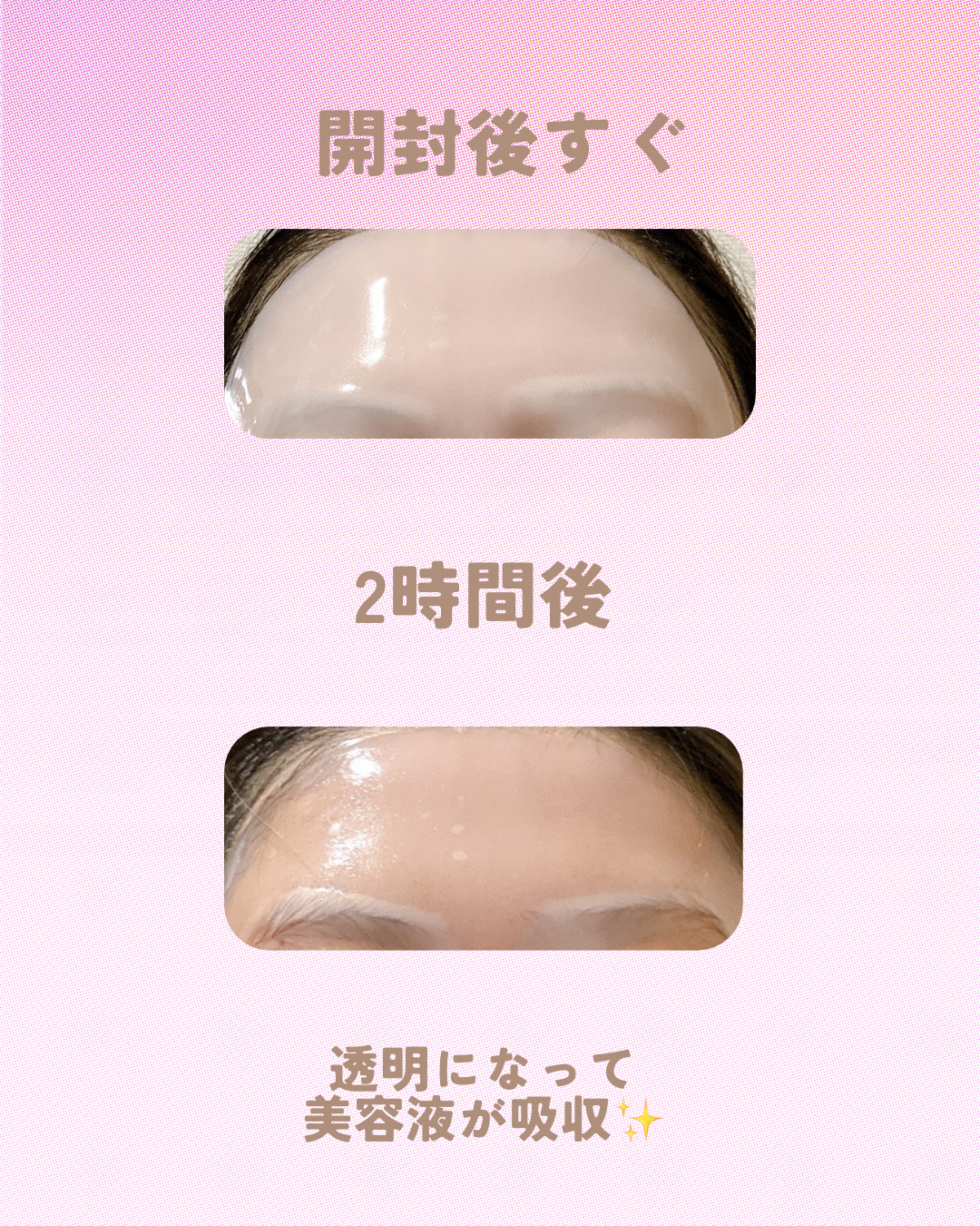 ハイパーコラーゲンマスク/MEDIHEAL/シートマスク・パックを使ったクチコミ（3枚目）