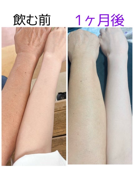 サファーデイ スノー/canteen9/美容サプリメントを使ったクチコミ(2枚目)