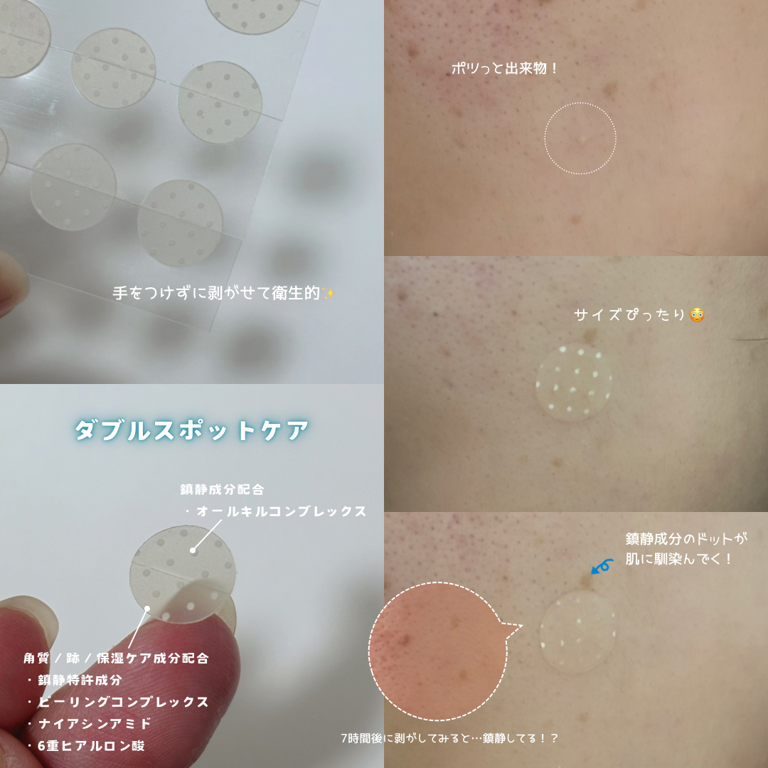 ノープロブレムスポットパッチ/ilso/その他スキンケアを使ったクチコミ（3枚目）