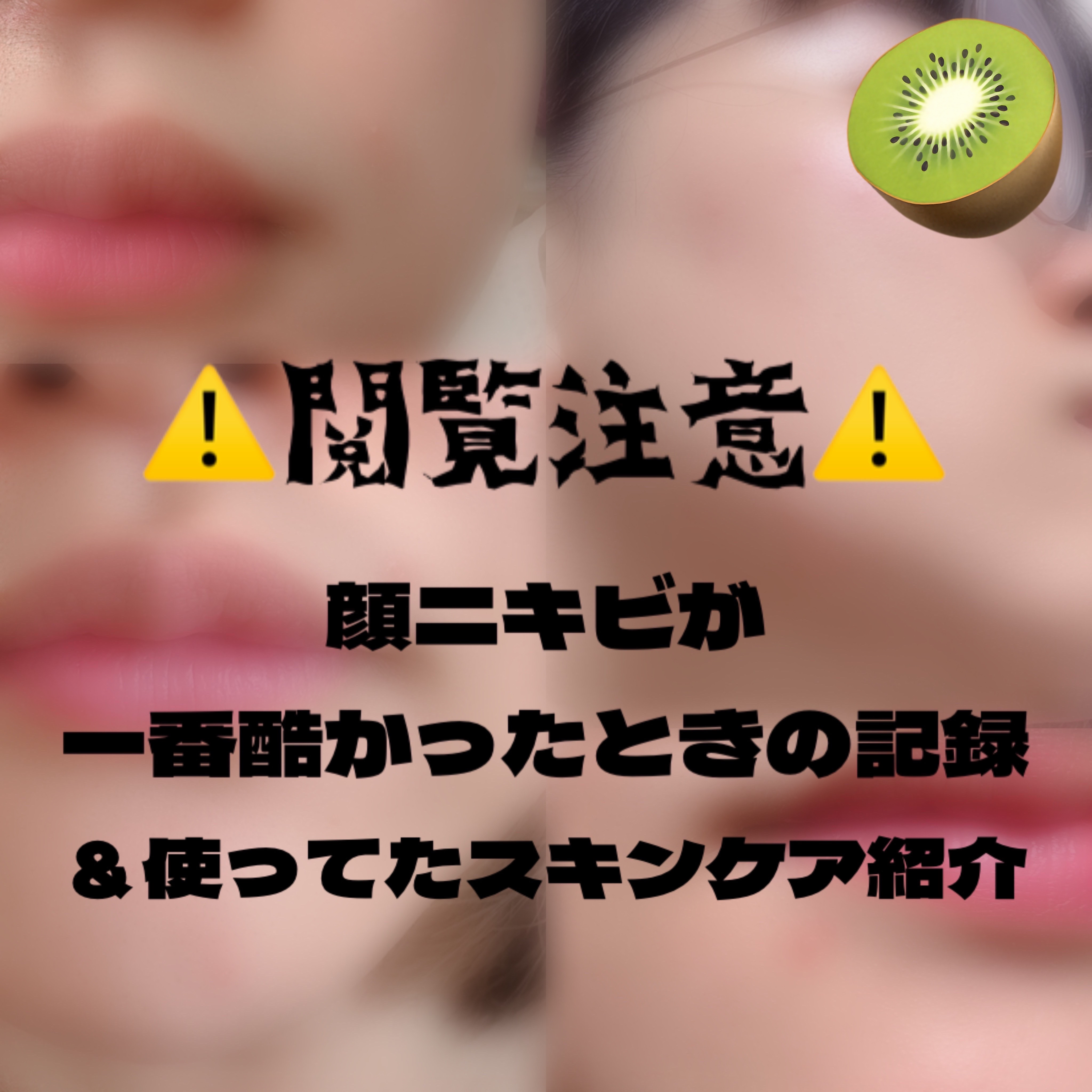 クリアフル モイスチャーL(さっぱりタイプ)/オルビス/乳液を使ったクチコミ（1枚目）