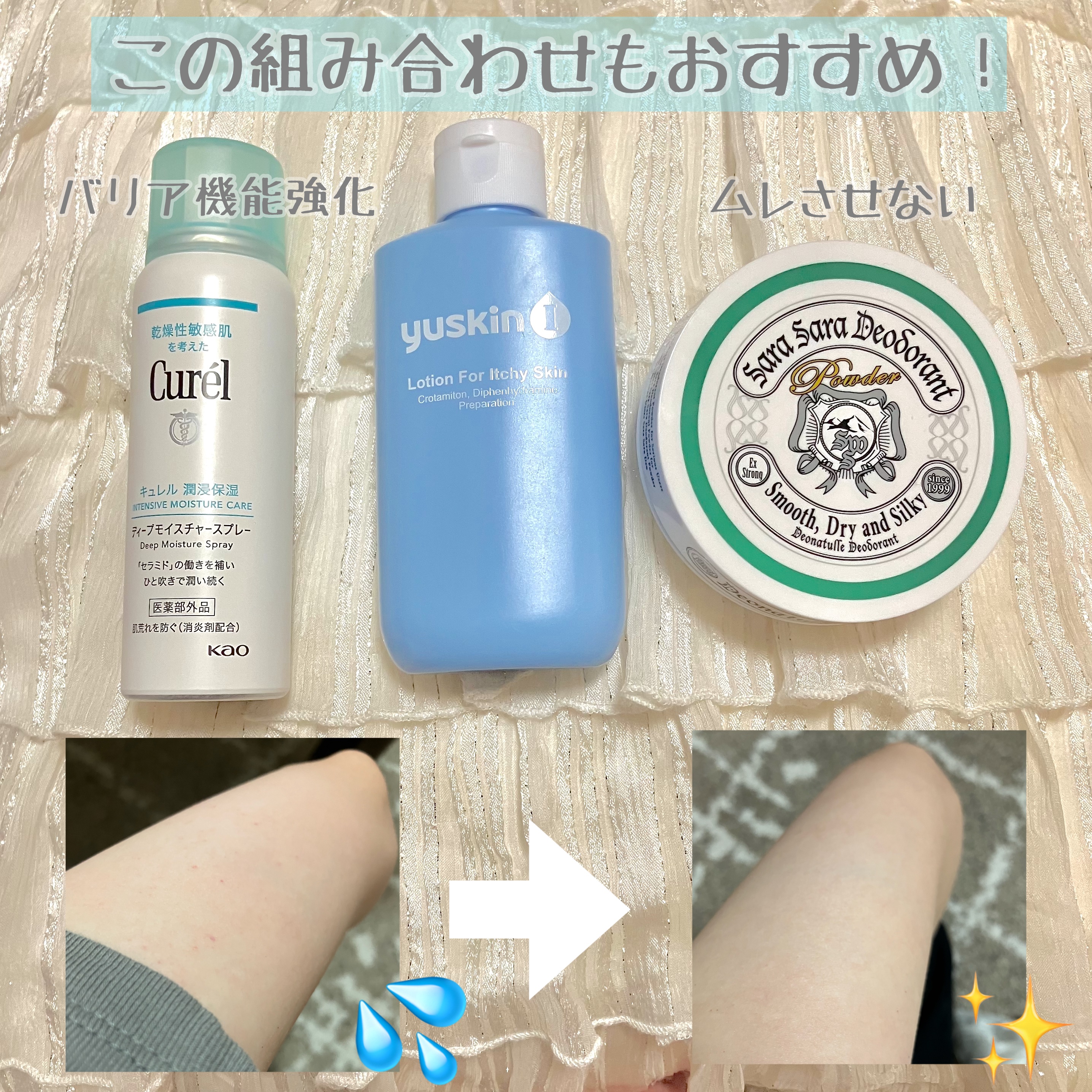 ユースキンIローション（医薬品）/ユースキンI(アイ)/その他を使ったクチコミ（2枚目）