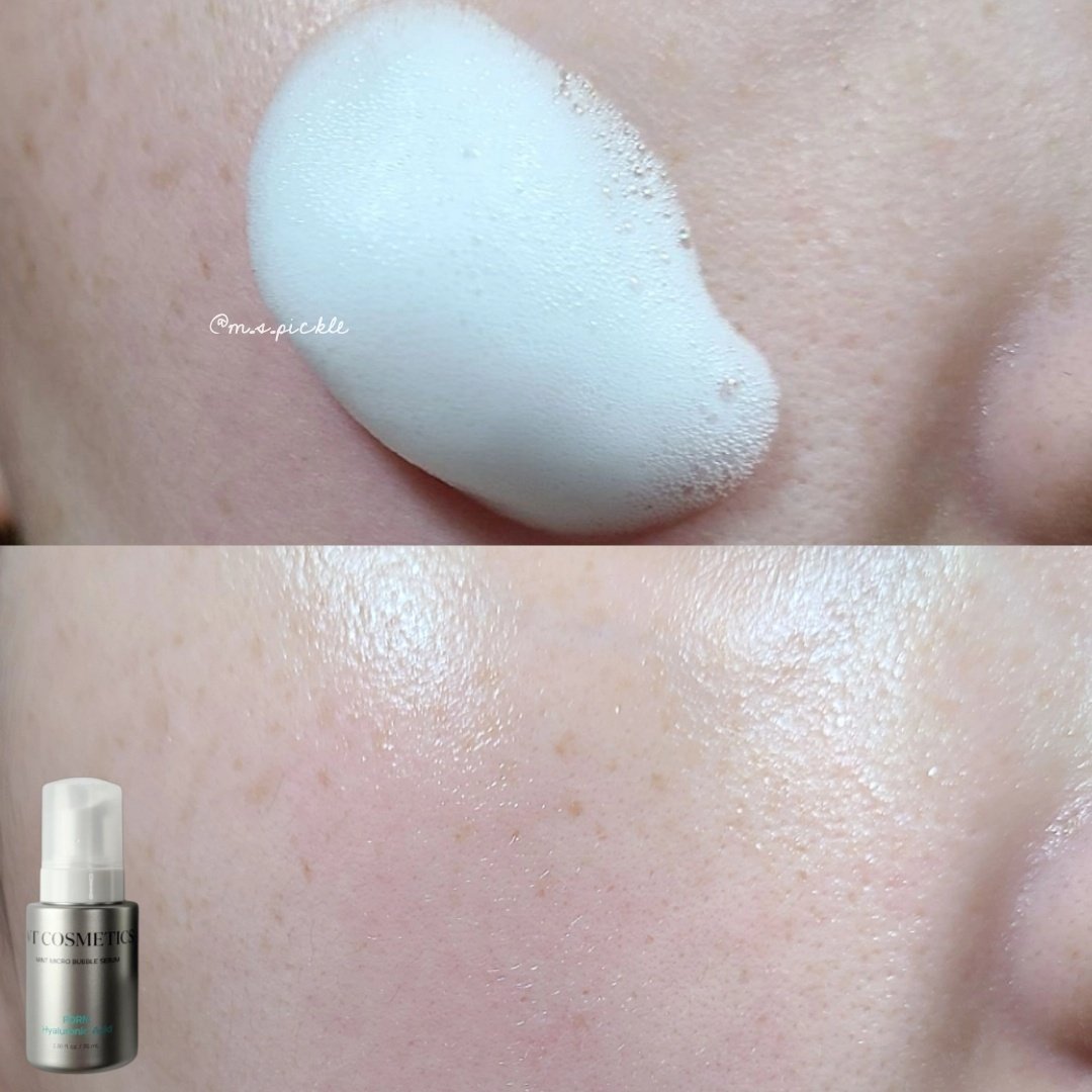 AZ AHA レッドマイクロバブルセラム/VT/美容液を使ったクチコミ（3枚目）