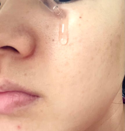 シークレットソリューションPDRNカプセルアンプル/It's skin/美容液を使ったクチコミ(3枚目)