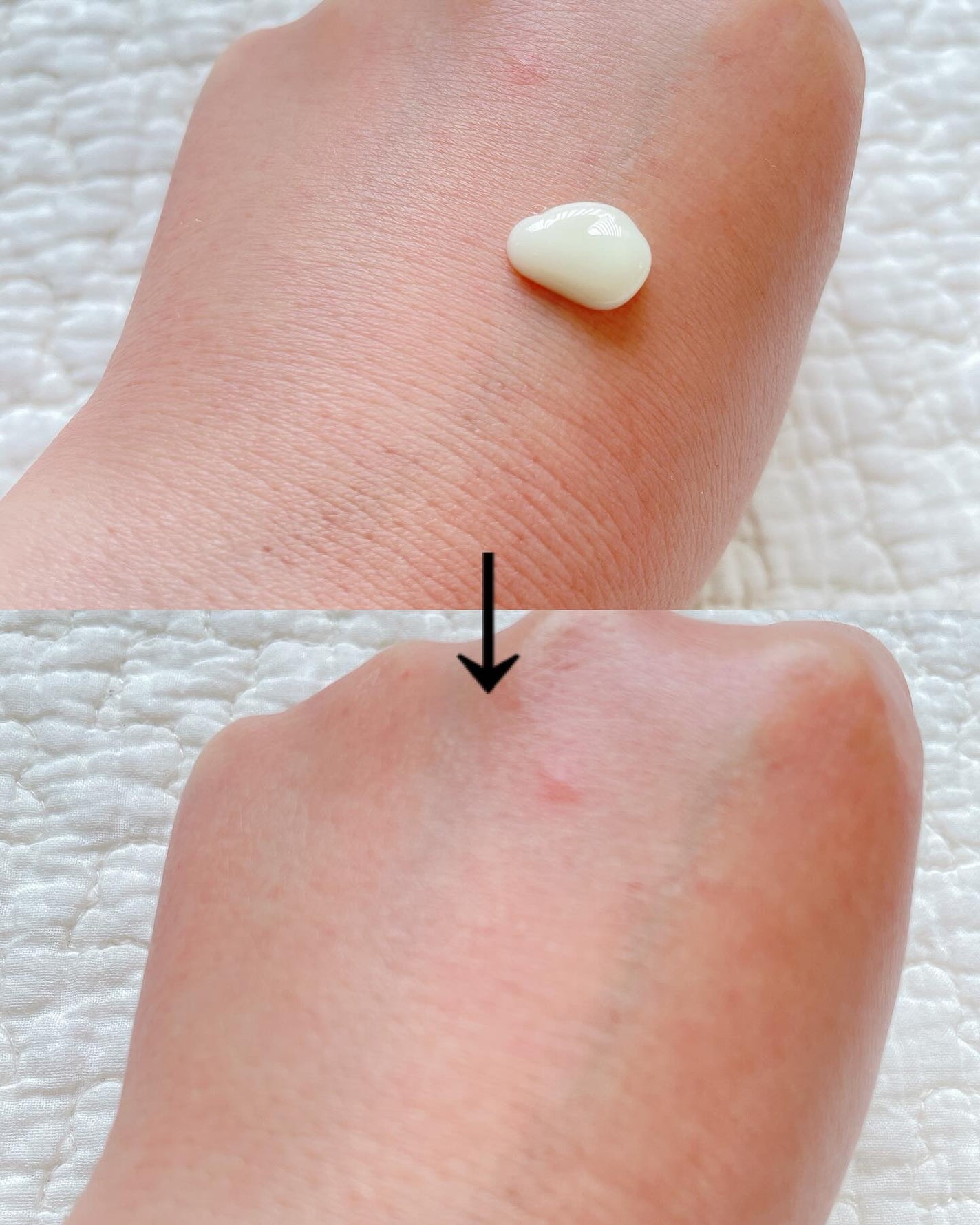 マスティックパーフェクトアンプル/Mastina/美容液を使ったクチコミ(2枚目)