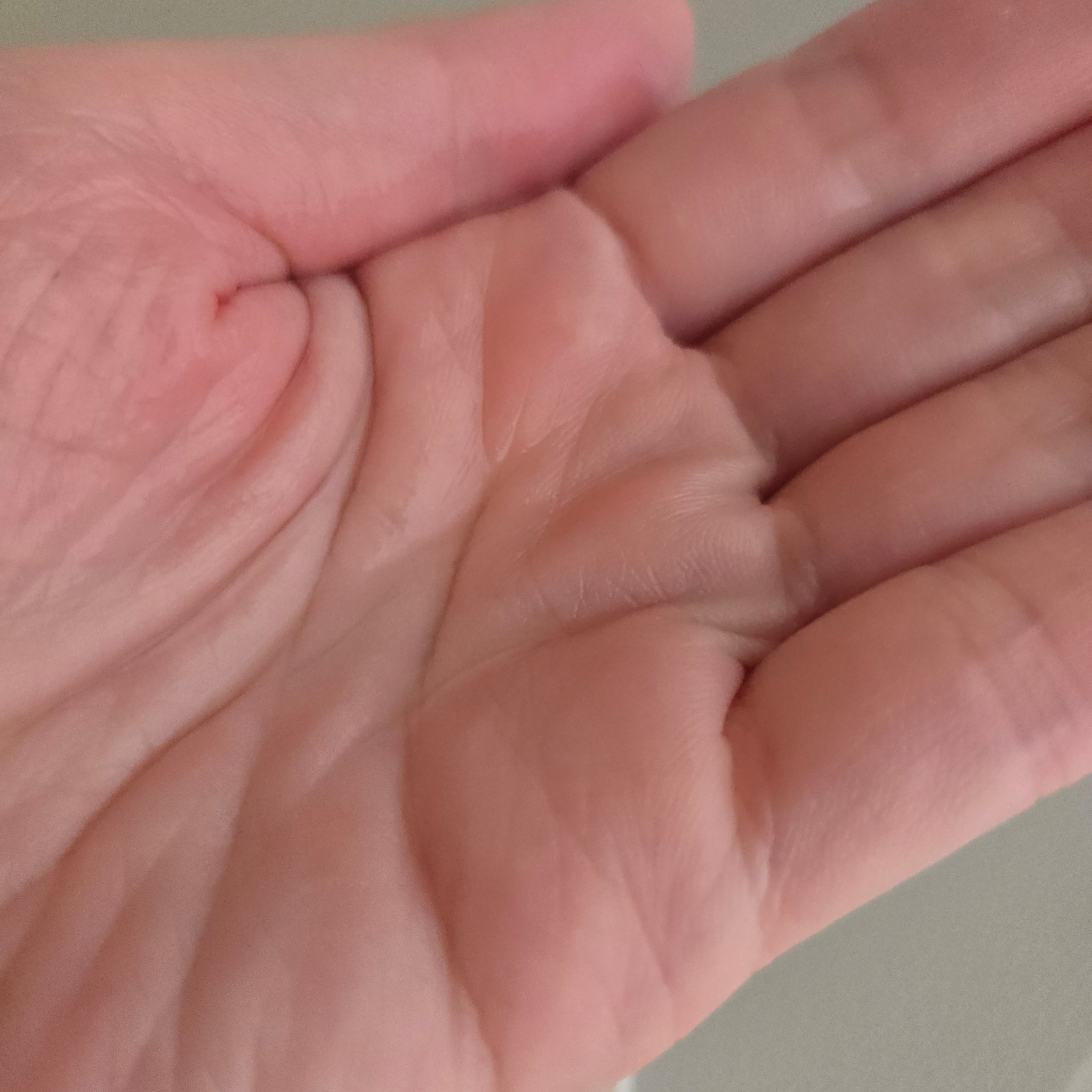 薬用モイストローション/NALC/化粧水を使ったクチコミ（3枚目）