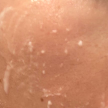 PHセンシティブクラウドピーリングジェル/SAM'U/ピーリングを使ったクチコミ(4枚目)