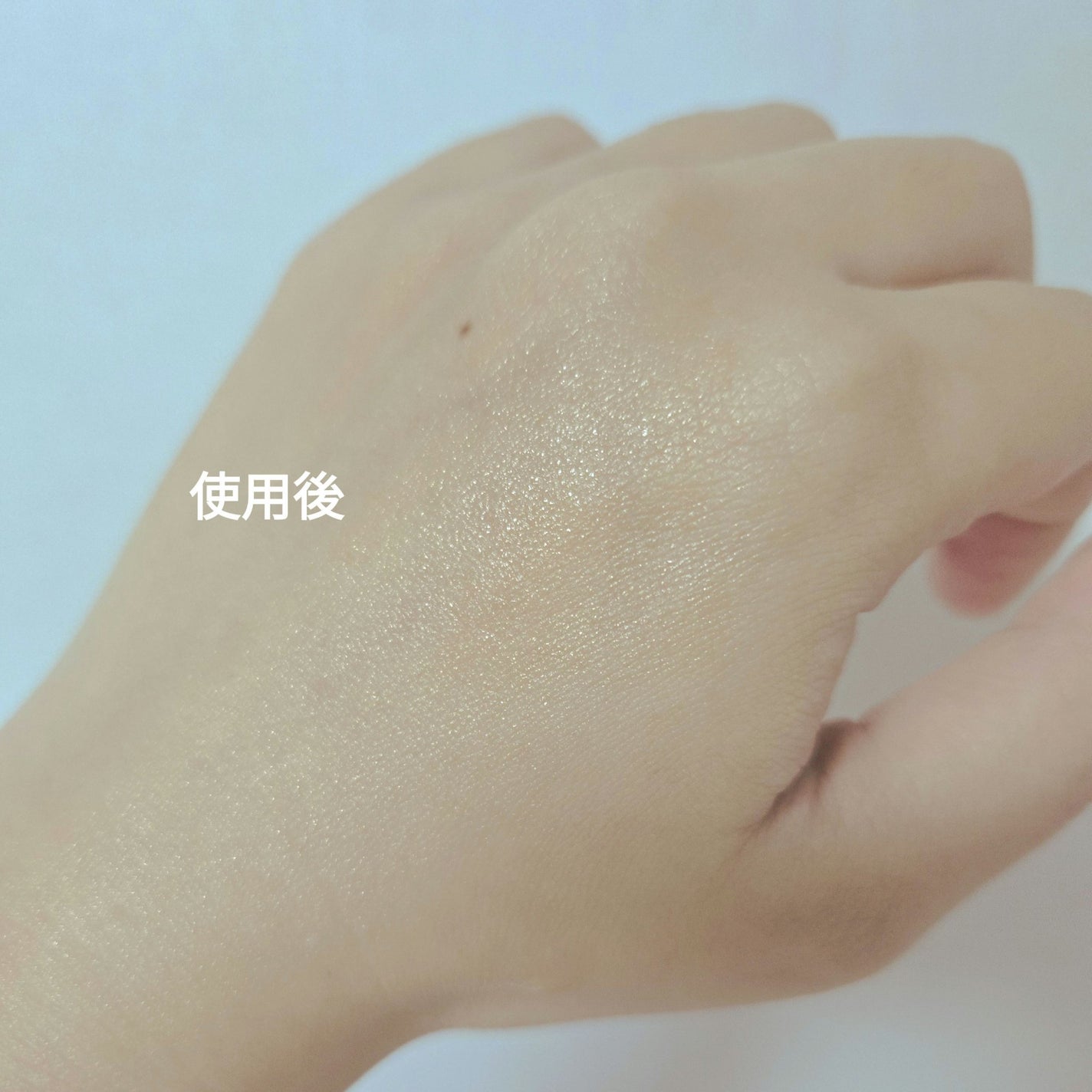 RXザ・アルファアルブチン2 ニキビ跡ケアセラム/COSRX/美容液を使ったクチコミ(9枚目)