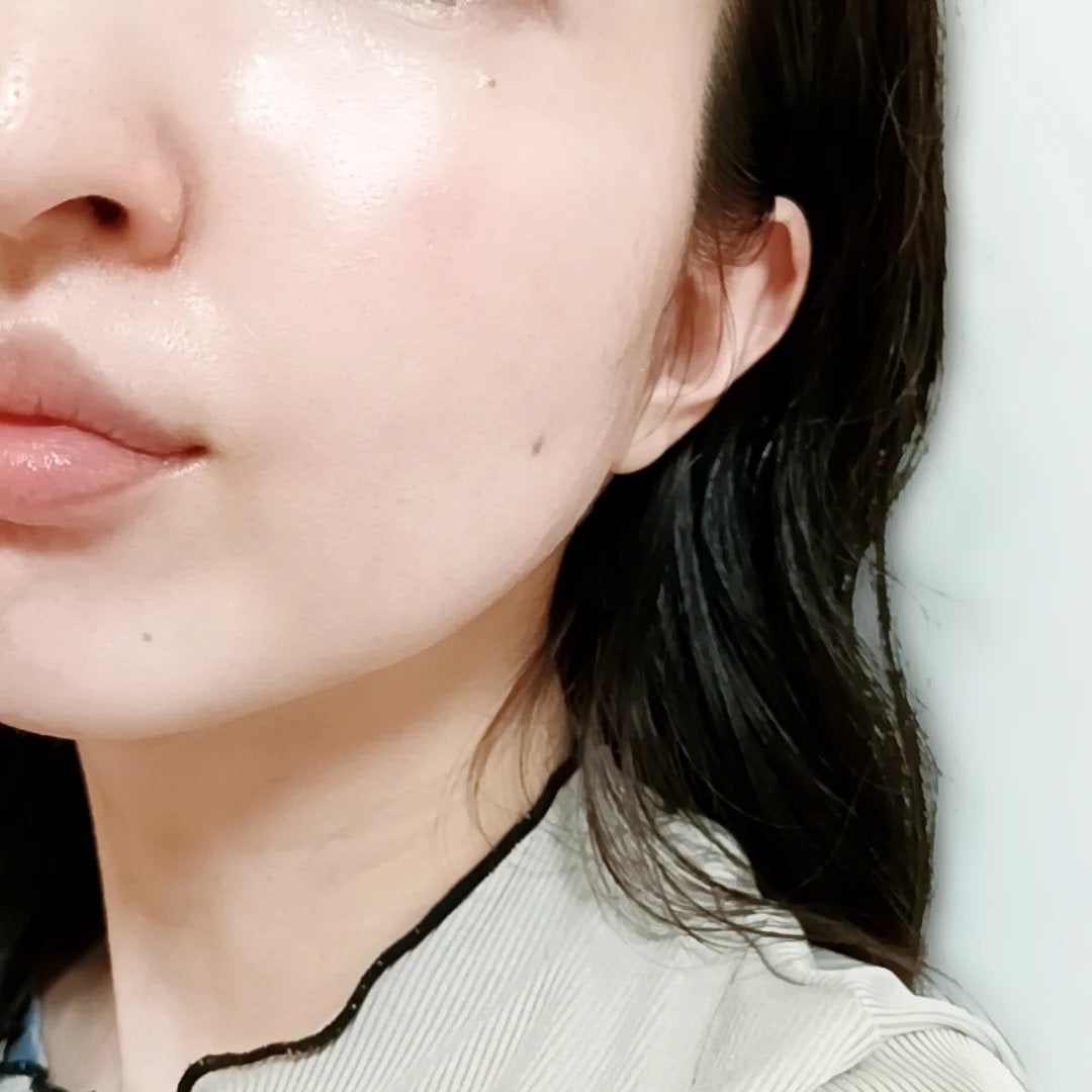 ノスカナイン トラブル セラム/FATION/美容液を使ったクチコミ(5枚目)