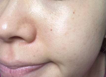 シークレットソリューションPDRNカプセルアンプル/It's skin/美容液を使ったクチコミ(5枚目)