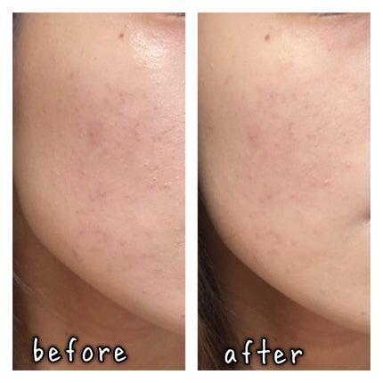 トランスルーセントセットフィニッシングパウダー/TFIT/ルースパウダーを使ったクチコミ(4枚目)