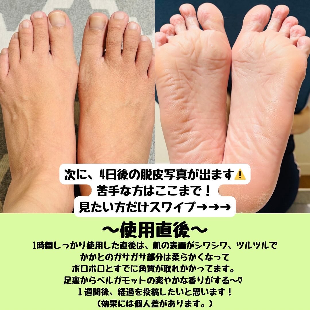 イージーパックDP60分タイプ/ベビーフット/レッグ・フットケアを使ったクチコミ(2枚目)