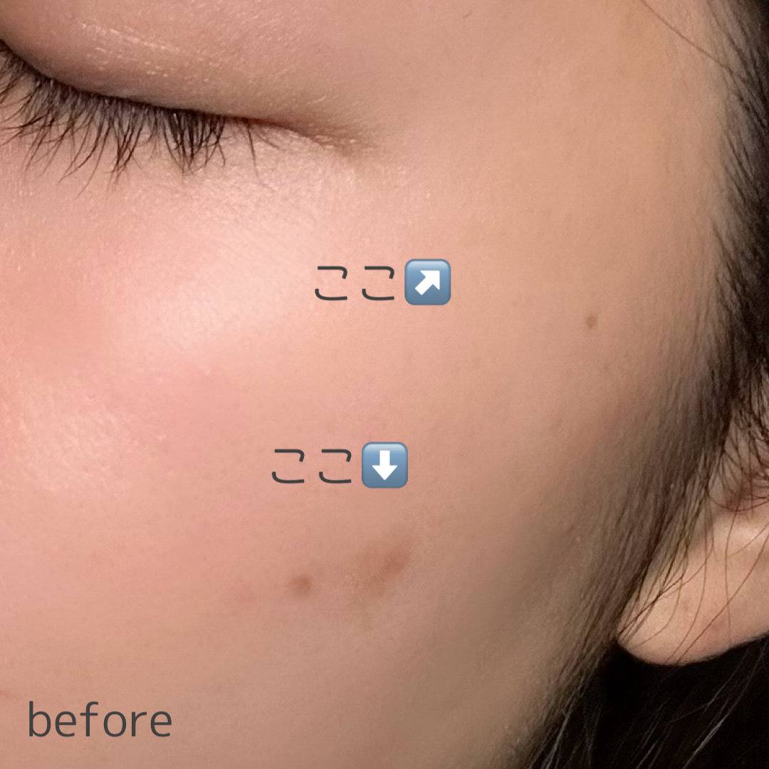 を使ったクチコミ（2枚目）