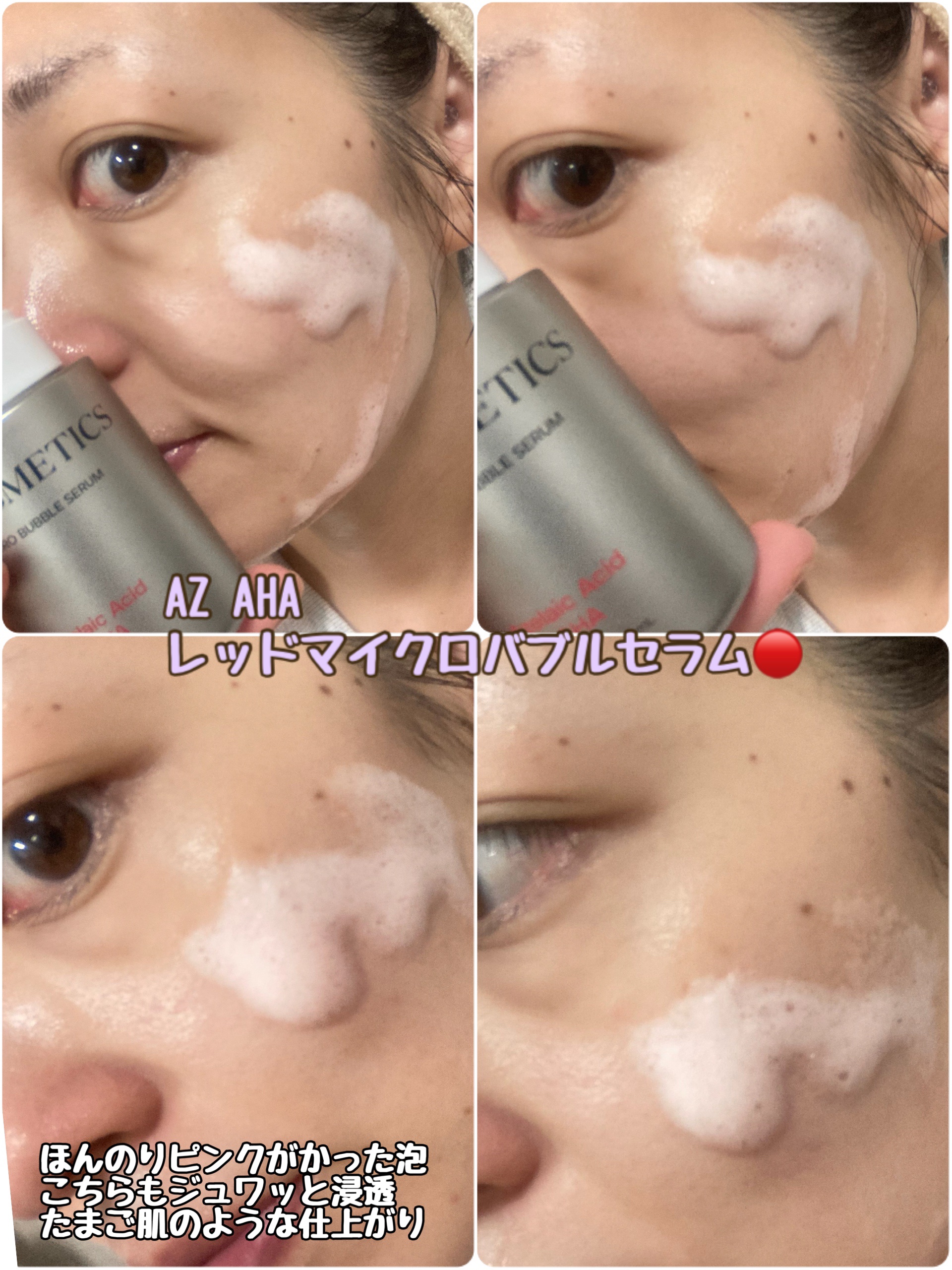 PDRN ヒアルロン酸 ミントマイクロバブルセラム/VT/美容液を使ったクチコミ（3枚目）