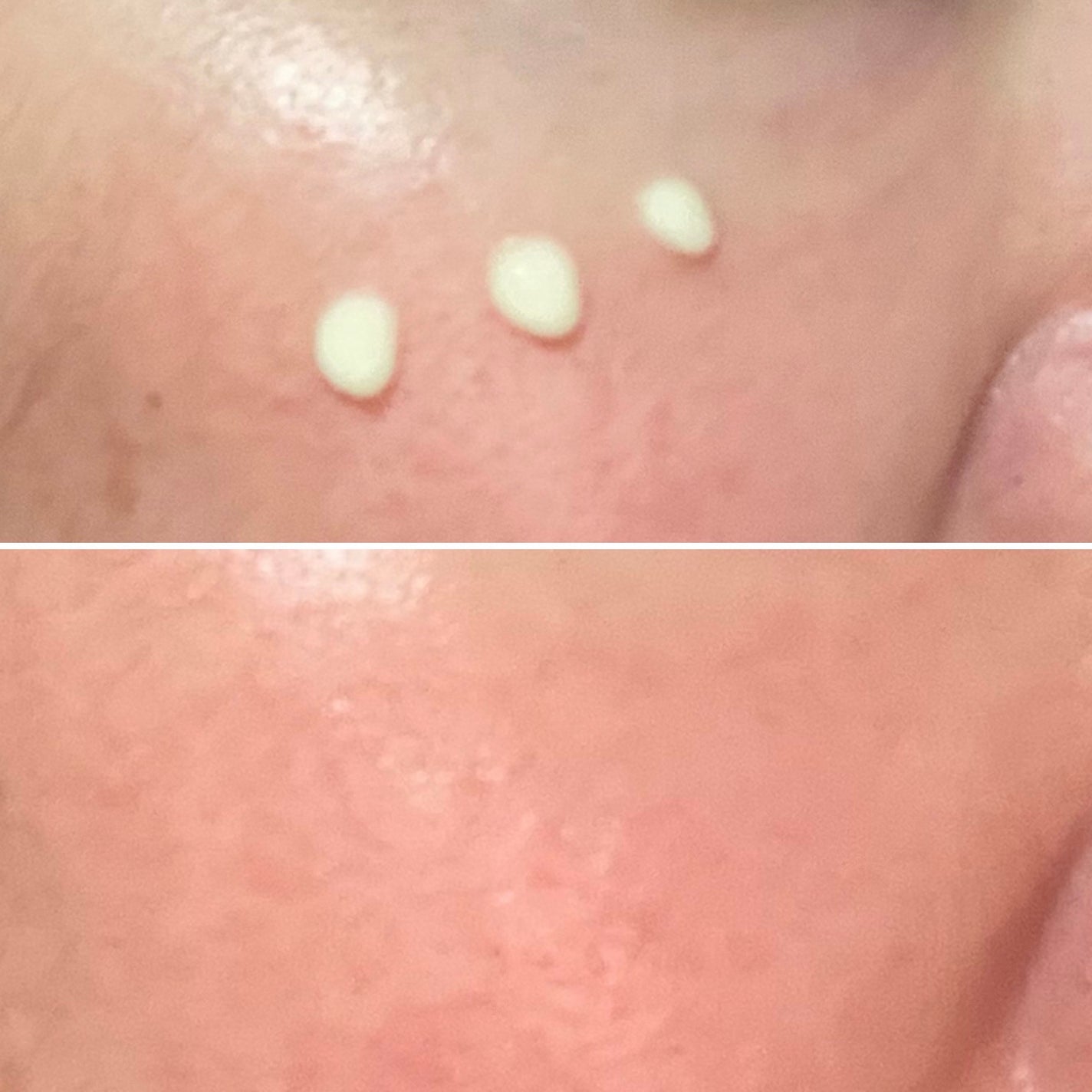 ヴィーガンリポソームレチノールセラム/SKIN&LAB/美容液を使ったクチコミ(3枚目)