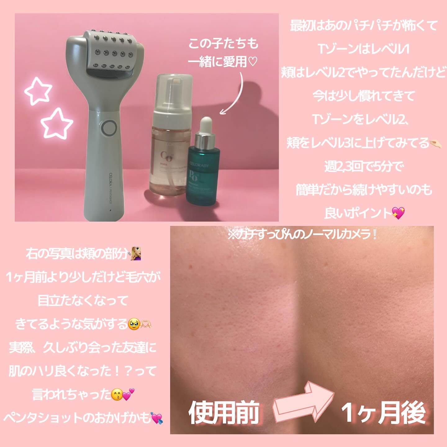 ペンタショット/CELORABY/美顔器・マッサージを使ったクチコミ（2枚目）