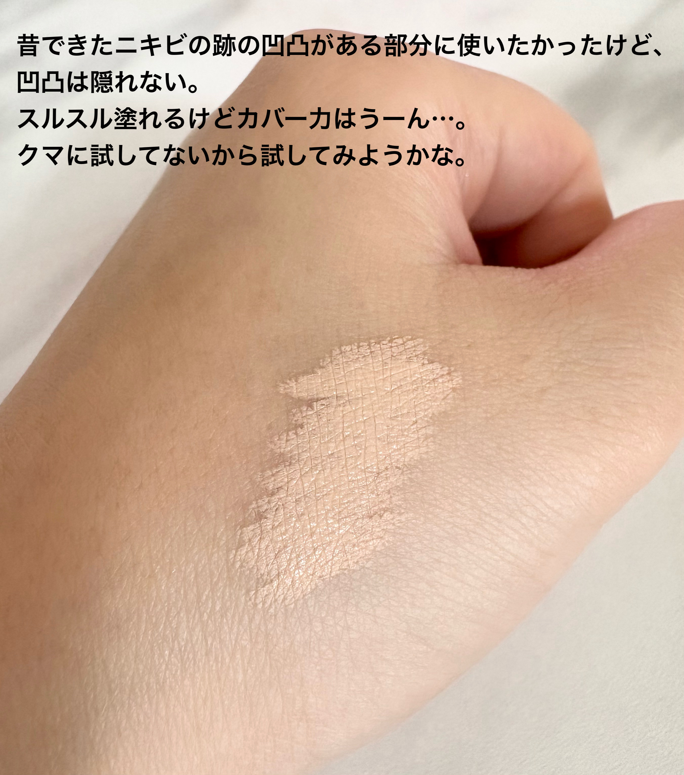 湘南美容コンシーラー/湘南美容/スティックコンシーラーを使ったクチコミ（2枚目）