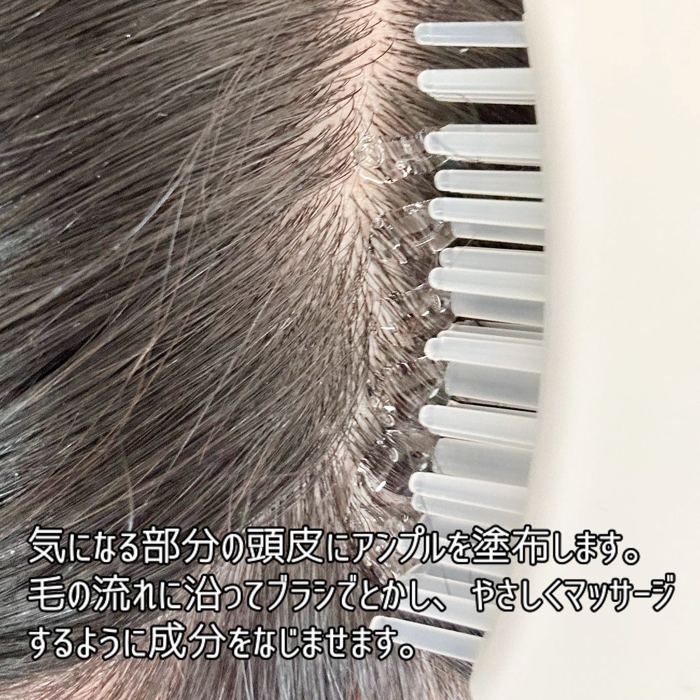 グローターンヘアアンプル/リリーイブ/頭皮ローションを使ったクチコミ(5枚目)