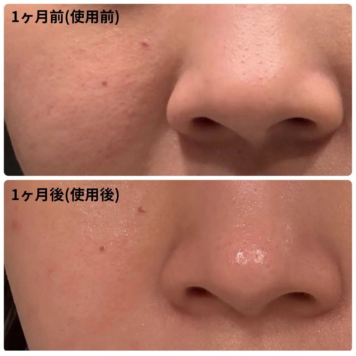 ペンタショット/CELORABY/美顔器・マッサージを使ったクチコミ(2枚目)