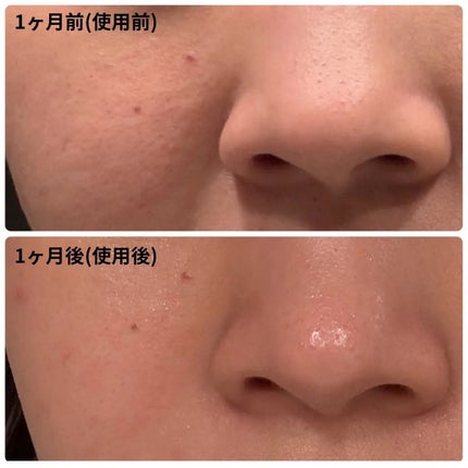 ペンタショット/CELORABY/美顔器・マッサージを使ったクチコミ(2枚目)