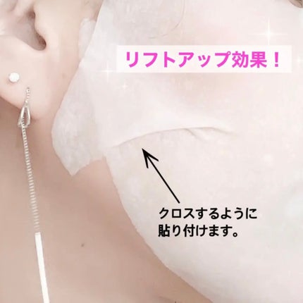 ルルルン ハイドラ V マスク/ルルルン/シートマスク・パックを使ったクチコミ(5枚目)