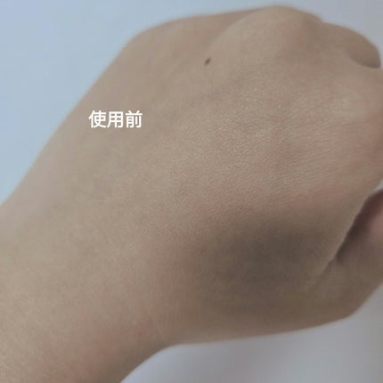 RXザ・アルファアルブチン2 ニキビ跡ケアセラム/COSRX/美容液を使ったクチコミ(8枚目)