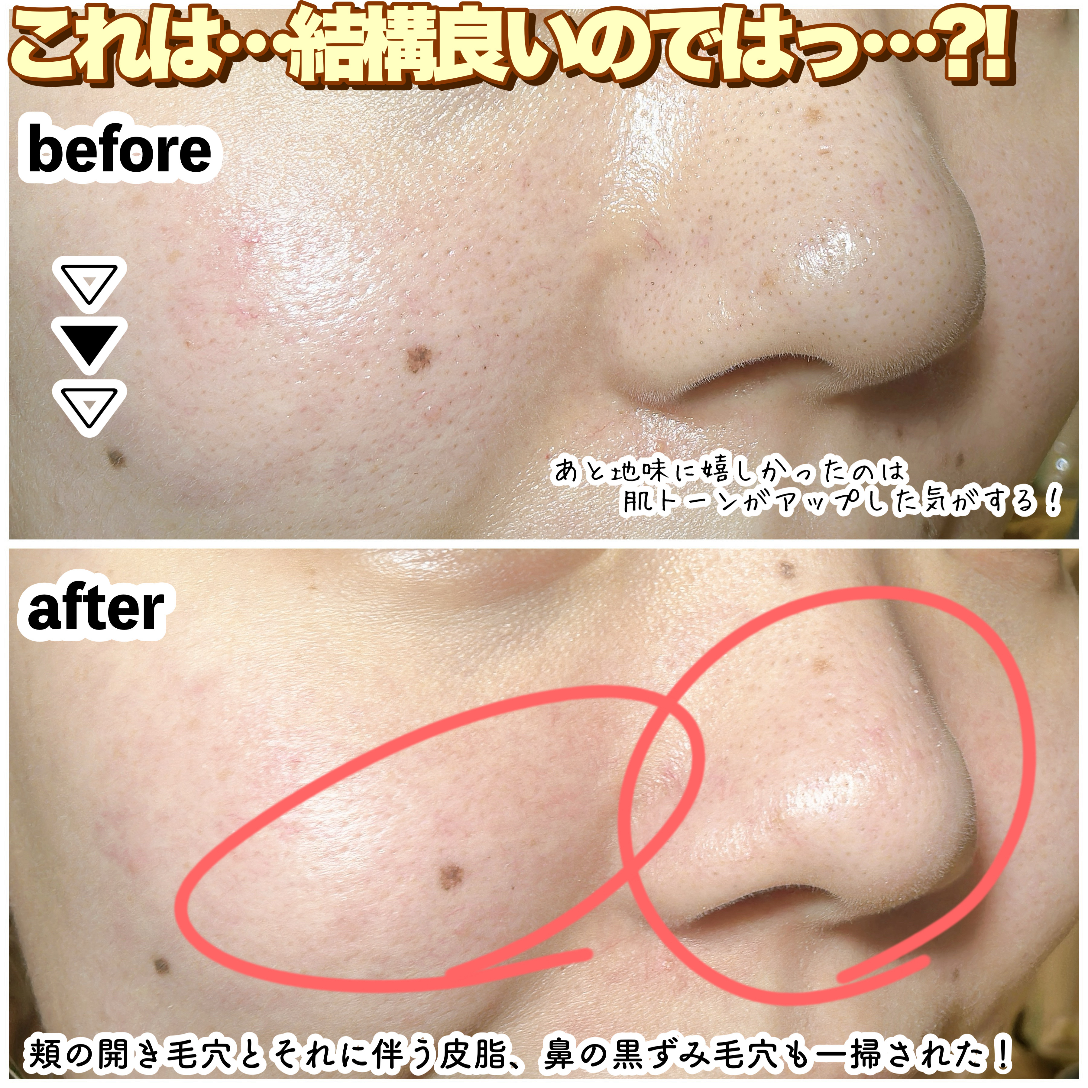 ポアクリア スクラブ ウォッシュ/ONE BY KOSE/洗顔フォームを使ったクチコミ（3枚目）