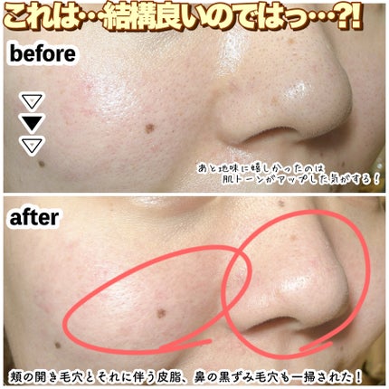ONE BY KOSE ポアクリア スクラブ ウォッシュのクチコミ「【バズり商品はダテじゃない⁈KOSEスクラブ洗顔検証!】
SNSで大バズりしてるのを見かけて.....」(3枚目)