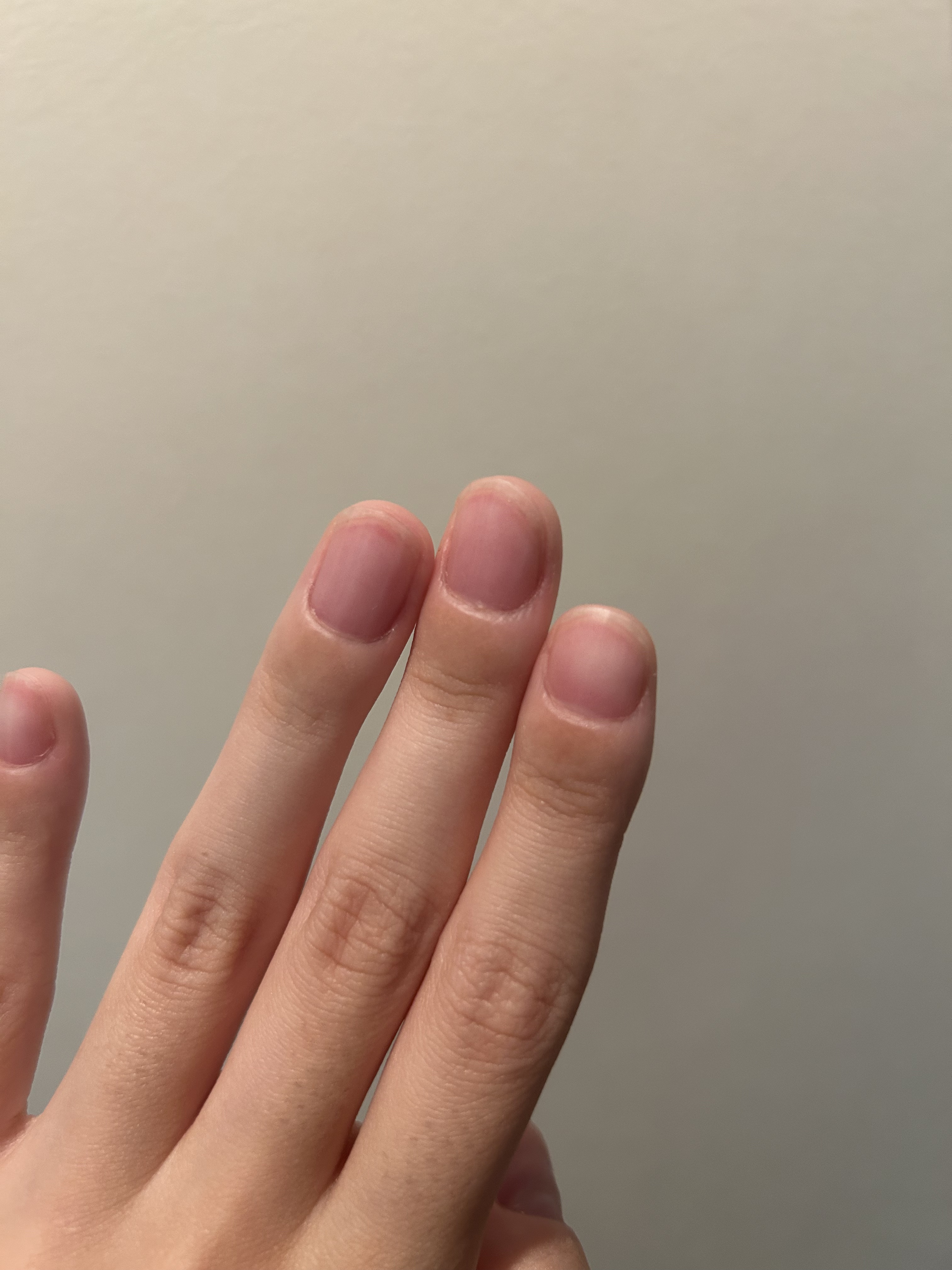 ボタニカルネイルオイル/キャンメイク/ネイルオイル・トリートメントを使ったクチコミ（2枚目）