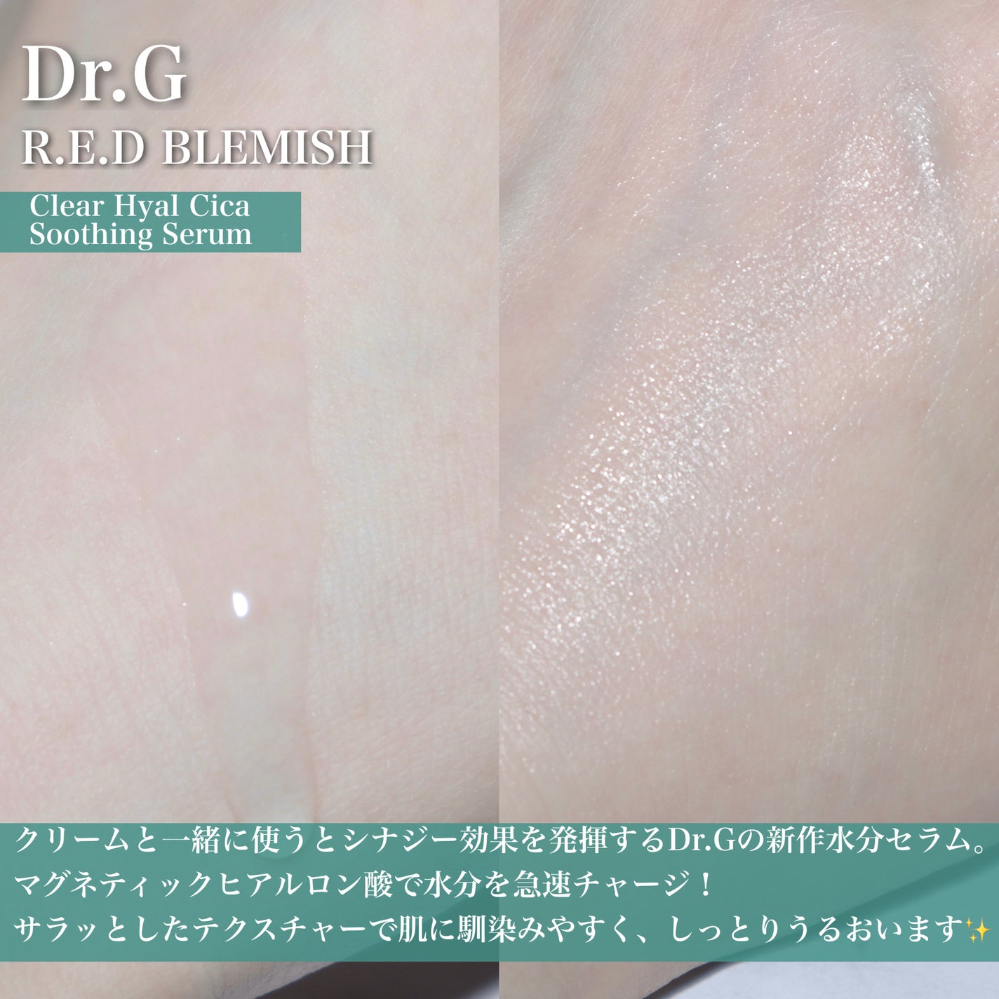 レッドブレミッシュ クリアスージングクリーム/Dr.G/フェイスクリームを使ったクチコミ(4枚目)