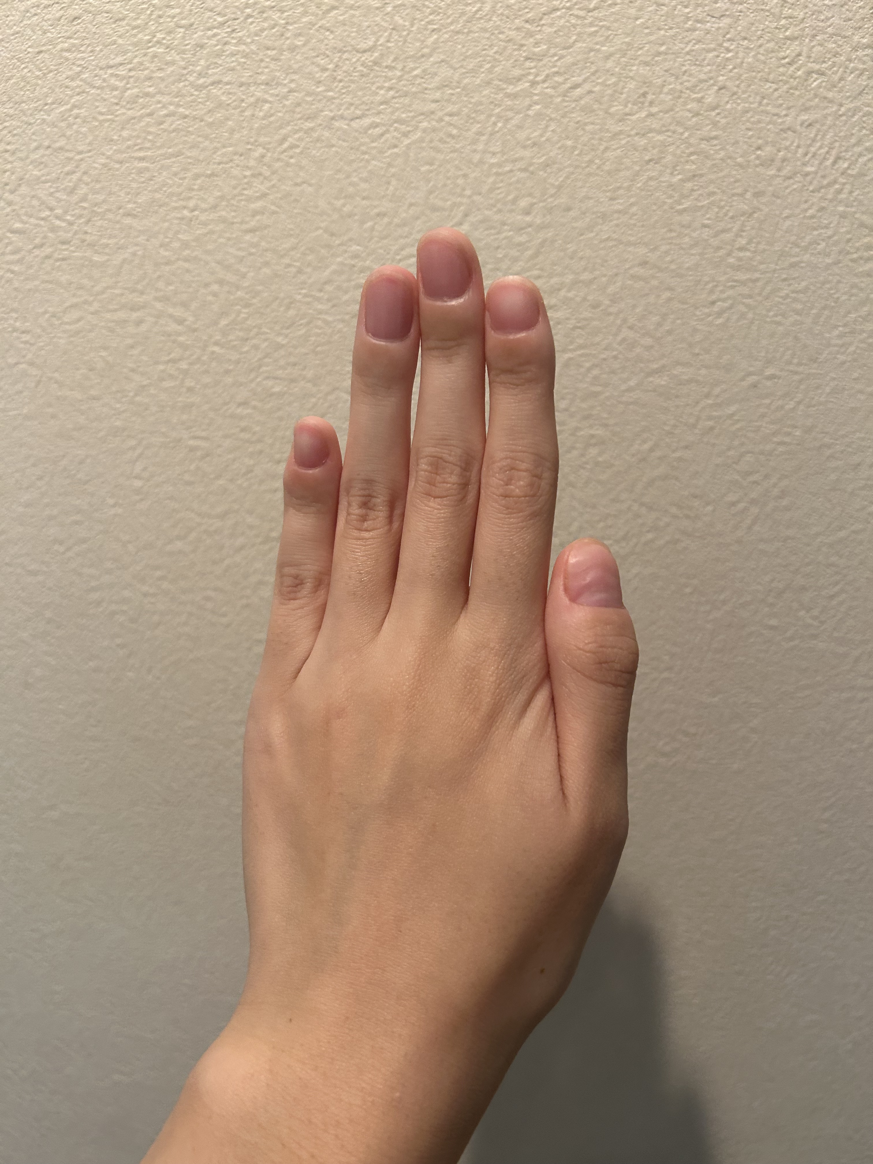 ボタニカルネイルオイル/キャンメイク/ネイルオイル・トリートメントを使ったクチコミ（1枚目）