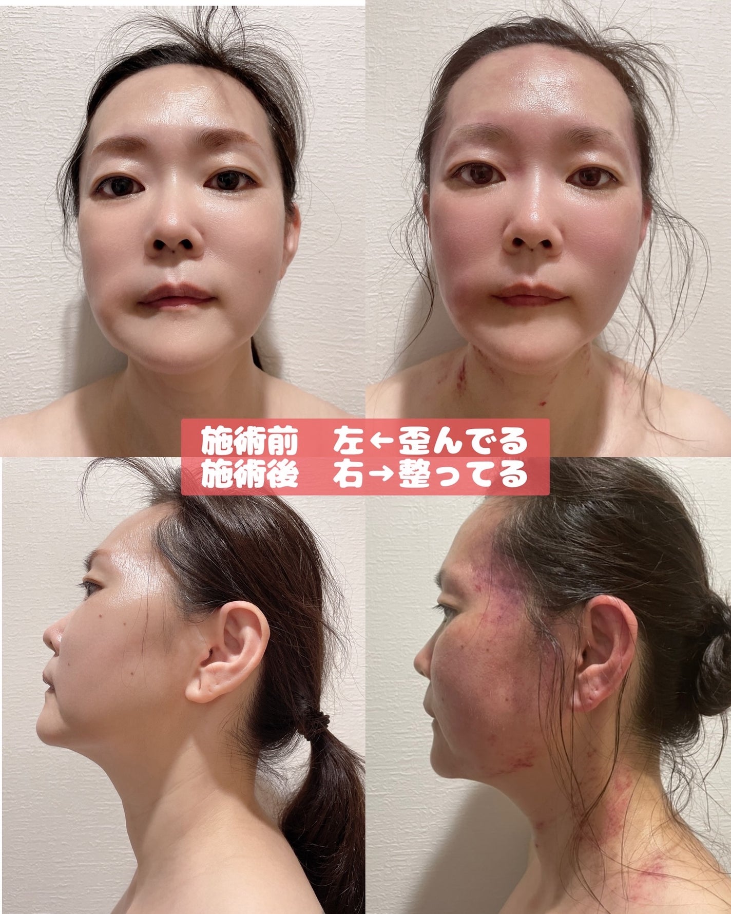 しのち☀️ on LIPS 「全国8人くらいのしのちビューティーファンの皆さまごきげんよう過..」(10枚目)