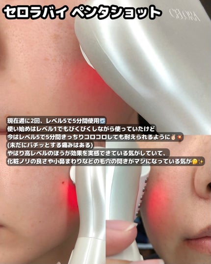 ペンタショット/CELORABY/美顔器・マッサージを使ったクチコミ(2枚目)