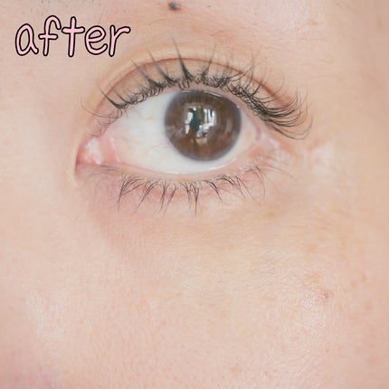 BAKUCHI NEEDLE SHOT DARK CARE AUTO EYE CREAM/LIALUSTER/アイケア・アイクリームを使ったクチコミ(8枚目)