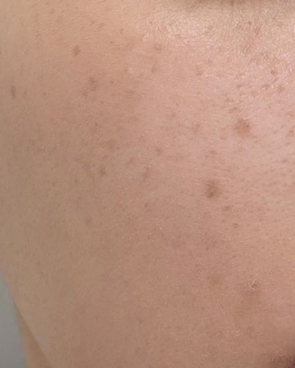 スタジオ ラディアンス 24 ルミナス コンシーラー/M・A・C/リキッドコンシーラーを使ったクチコミ(4枚目)